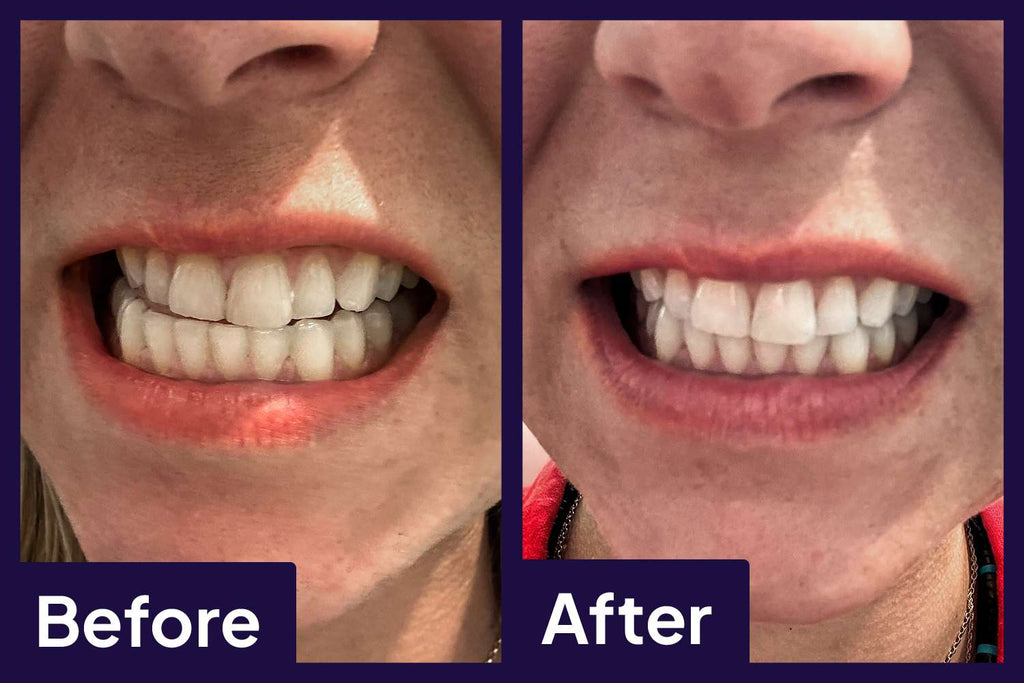 Stain Whitening Mouthwash
