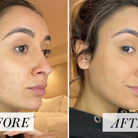 BB Cream Tinted Moisturizer Concealer